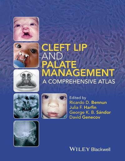 Cleft Lip and Palate Management, Wiley, eBook, PDF - BUKU
